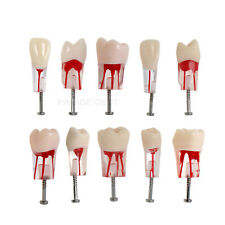 10PCS Kilgore Nissin Type Dental Endo Root canal Practise Typodont Teeth Model picture